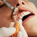 periodontal disease