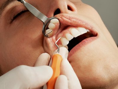 periodontal disease