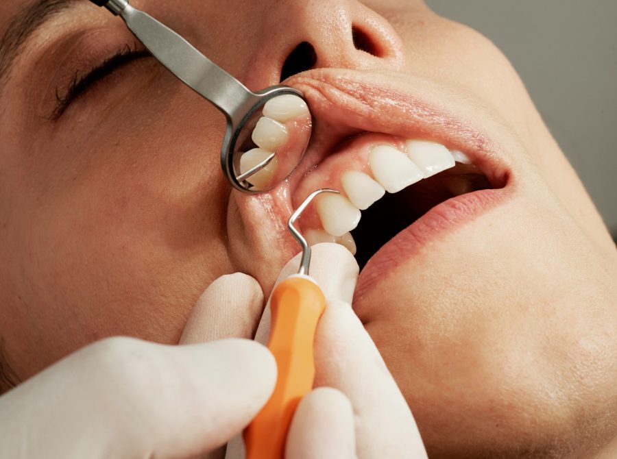periodontal disease